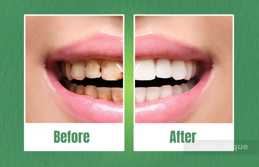 help-strengthen-teeth-and-healthy-gums